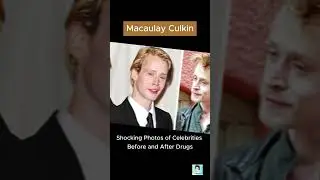 Shocking Photos of Celebrities Before and After 