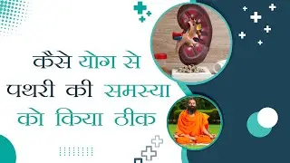 कैसे योग से पथरी (Stone) की समस्या को किया ठीक || Swami Ramdev