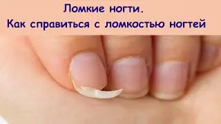 Ломкие ногти. Как справиться с ломкостью ногтей.