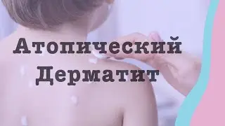 Атопический дерматит - 10 распространенных мифов