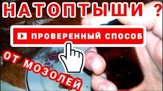 ОТ МОЗОЛЕЙ - Проверенное Средство. Эффективное средство от Натоптышей / PRO опыт