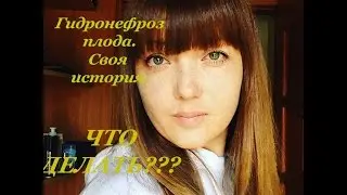 ГИДРОНЕФРОЗ ПЛОДА // Диагноз на УЗИ в 32 недели беременности.