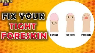 Do you have a Tight Foreskin |Your Foreskin cannot retract or pull back| how to fix a tight foreskin