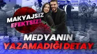 Dilan Polat'ı 'Güzellik' de Kurtarmadı: Makyajsız Finiş!