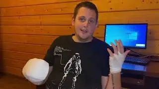 ПОЛУЧИЛ ТРАВМУ РАЗРЫВ СУХОЖИЛИЙ И НЕРВА / ЧЕРЕЗ СКОЛЬКО НАЧНУ РАБОТАТЬ?