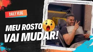 PRÉ-OPERATORIO DA MINHA CIRURGIA ORTOGNÁTIOCA COM DR NICKOLLAS