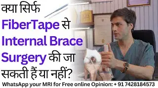 क्या सिर्फ FiberTape से Internal Brace Surgery की जा सकती हैं या नहीं? 