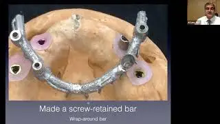 WEBINAR - Dental Implants and the Laboratory's Perspective