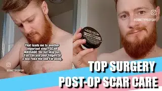 Top Surgery post-op scar care tips // FTM transgender