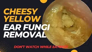 DON’T Watch This Video While EATING!