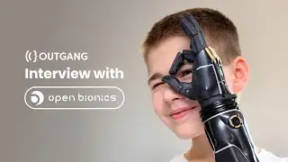 Using Blender and 3d Printing to Make Bionic Arms | Open Bionics Interview