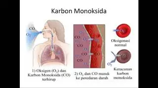 Materi Toksikologi lingkungan (Pertemuan Ke -2)