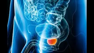 TESTICULAR TORSION Why ? What are the reasons? What are the symptoms? #health #testicularcancer