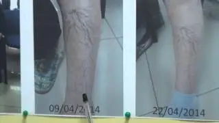 Вены на 