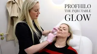 Profhilo, The Injectable Glow, session 3 and results