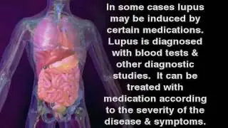 What is Lupus - Lupus Symptoms in women and men
