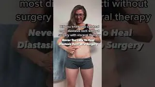 Diastasis Recti Treatment w/o Surgery with The Belly Whisperer 