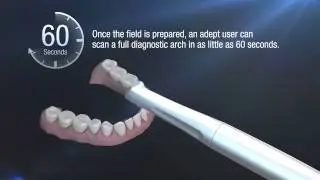 Nuevo Scanner Intraoral 3M True Definition