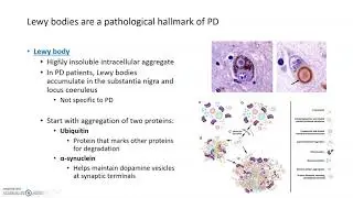 Parkinson's Disease Symptoms and Pathology