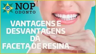 Faceta de resina