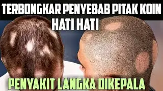 HATI HATI PITAK KOIN PENYAKIT LANGKA!!!  TERNYATA INI PENYEBABNYA