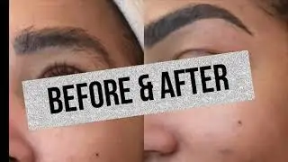 Brow transformation