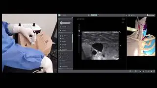 Guided central line placement tutorial and simulator hands-on demonstration