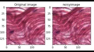 Top Data Augmentation Techniques for Computer Vision