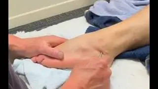 Intensely deep foot and leg massage using tool. Correcting a bunion and twisted toes. Raynor massage
