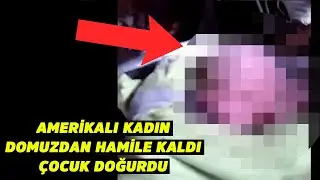 AMERİKALI KADIN DOMUZDAN HAMİLE KALDI, ÇOCUK DOĞURDU