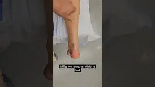 Diagnosing Torn Achilles Tendon | Family Foot & Leg Center