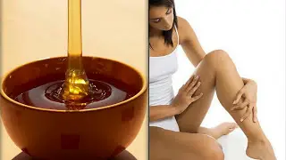 Sugaring of intimate area.Recipe and application