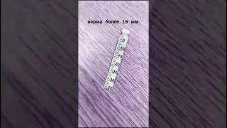 тест на слезопродукцию 
