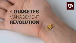 Biosensor implant will replace needle prick