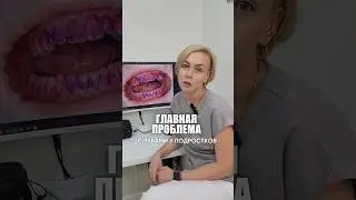 Подростковая гигиена полости рта требует внимания родителей!