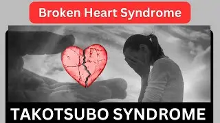 TAKOTSUBO Syndrome