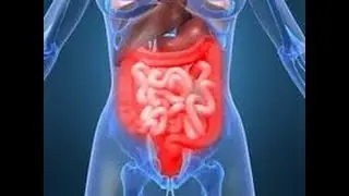 Why Do Hemorrhoids Itch - Do Your Hemorrhoids itch?