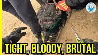 Blood-Soaked Rope Choking This Seal