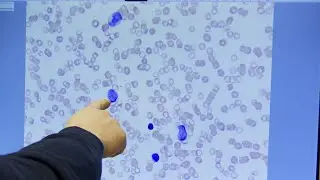 Blood Pathology