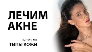 Типы кожи