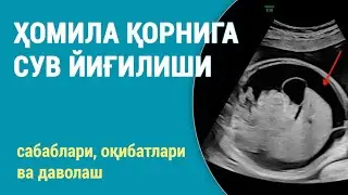 Ҳомила қорнига сув йиғилиши | Ҳомила истисқоси