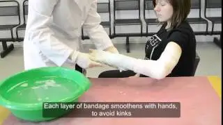 Циркулярная гипсовая повязка на предплечье