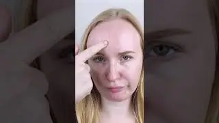 Помогает ли витамин С при аллергии?