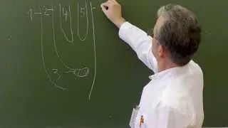 Пластика по Руджи при бедренных грыжах