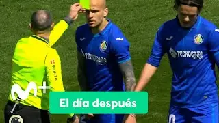 El Día Después (04/04/2022): Lo que el ojo no ve