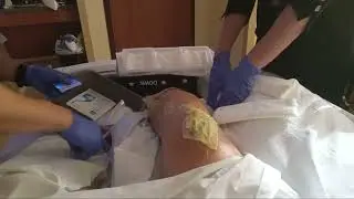 9. re-bandage my leg wound after motorcycle crash for those still think this is a gag