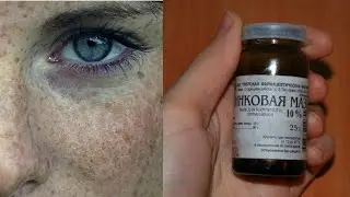 Бир томчи мазь ёрдамида юздаги догларни кетказиш,цинковая мазь от морщин и пятен  лица