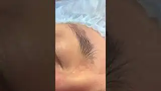 Удаляем тату брови при помощи   ремувера, Как удалить татуаж?