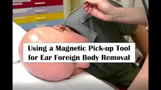 Using a Magnetic Pick-up Tool for Ear Foreign Body Removal