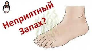 What to Do If Your Feet Smell and Sweat